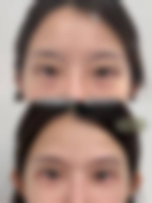 临床实例分享