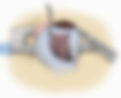 三、樊芯医生技术水平高