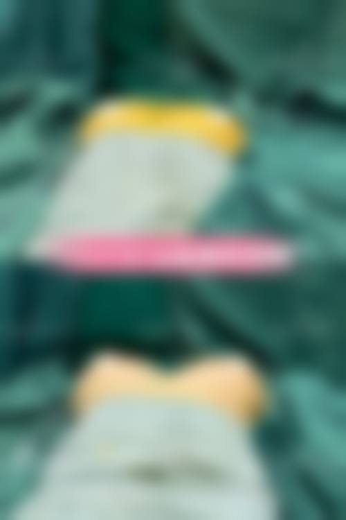 韓國自體脂肪隆胸存活率高嗎 術前術後護理秘訣