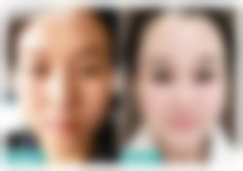 淮南韩一丽整形医院治疗反馈与口碑评价。