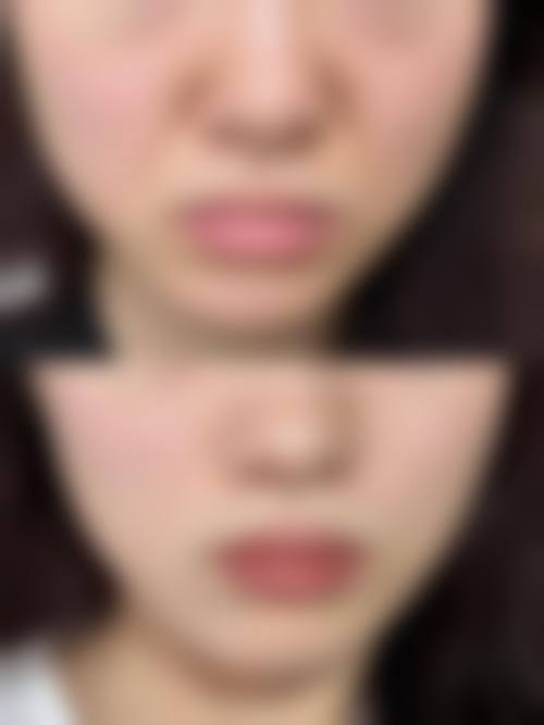 东莞雅乔整形医院门诊营业时间