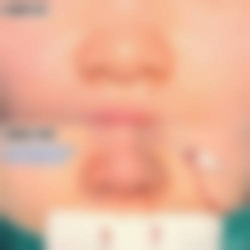 十、隆鼻手术价格影响因素