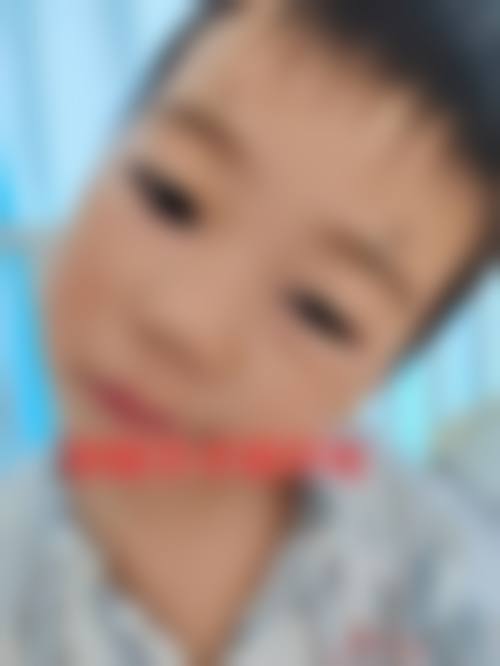 临床实例分享