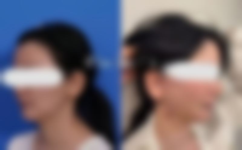 总结：信赖爱妮，安心变得更美