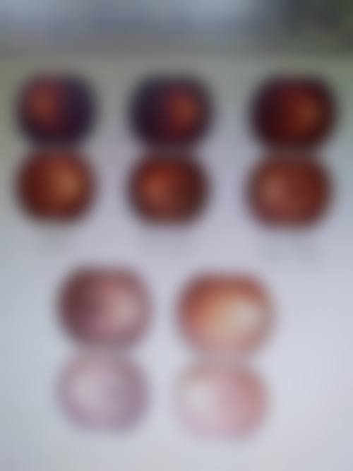 朱沛华擅长的眼科项目
