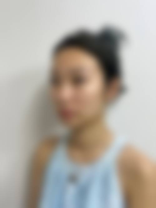 南京新生毛发种植研究院治疗反馈与口碑评价。