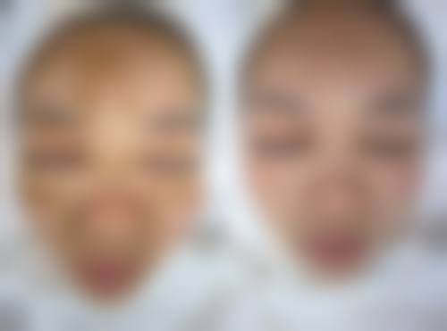 深圳珈溪（菲洛嘉）医疗美容诊所预约挂号方式。