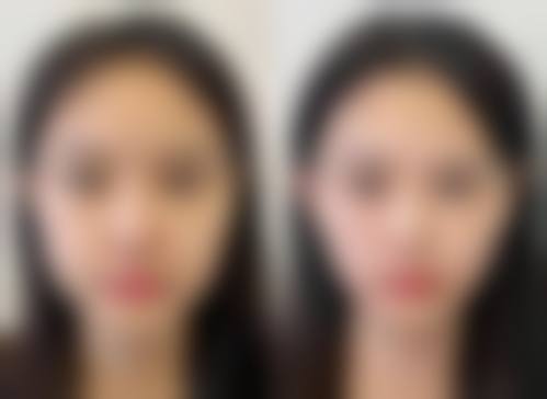 总结与预约号召