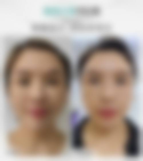 南京新生毛发种植研究院预约挂号方式。