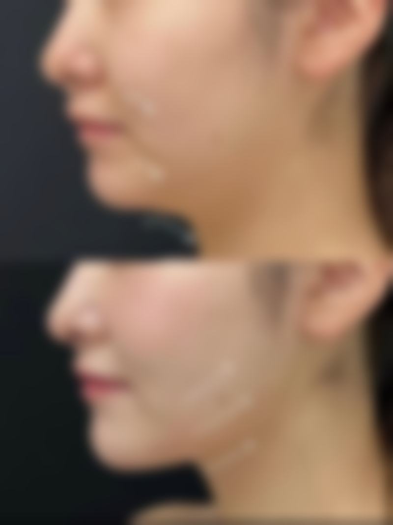 Cellpia医院患者常见问题解答(精选 )