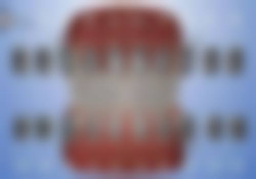 三、38岁牙齿矫正成效显著