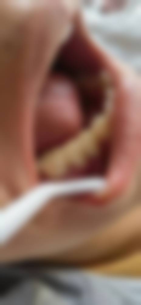 优惠活动详情:明码标价与限时补贴