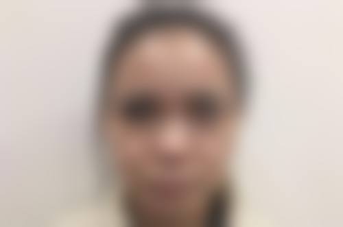 三、谢文胜医生技术水平高