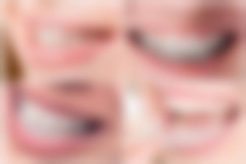 深圳正恩吉呈口腔门诊部擅长的项目