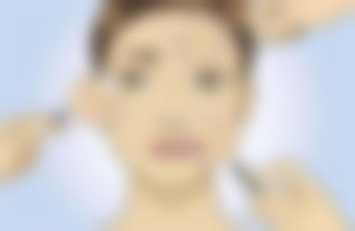 拓展延伸:韓國醫美項目真相+港澳姊妹選擇指南