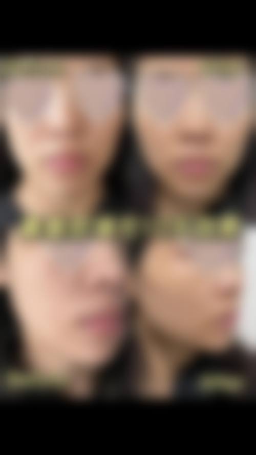 设备环境与安心保护:精良设备如何保护成效?