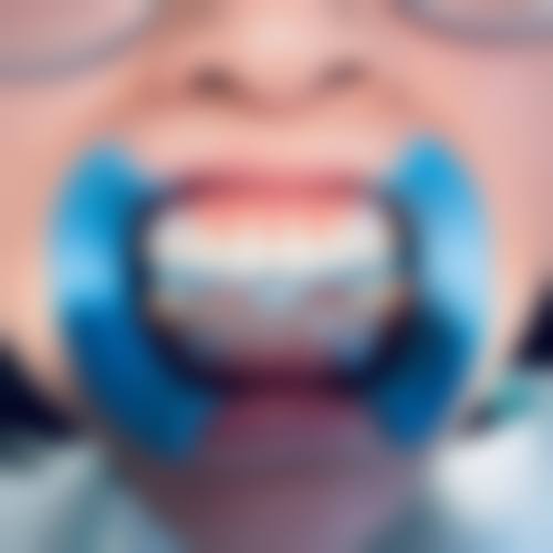 五、口腔习惯怎样影响儿童树脂补牙维持时间?