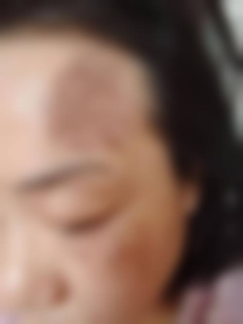 嘉兴昕欣然医疗美容门诊部治疗反馈与口碑评价。