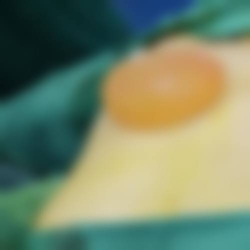 总结与预约号召