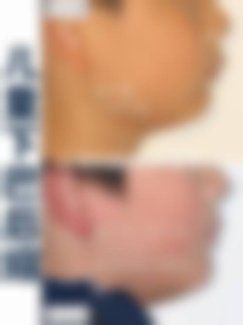 嘉兴昕欣然医疗美容门诊部医生团队经验稳定。