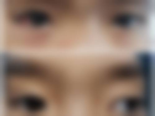 中南大学湘雅医院眼科预约挂号方式。