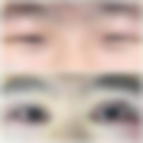 民航西安医院眼科2026年价格收费表: