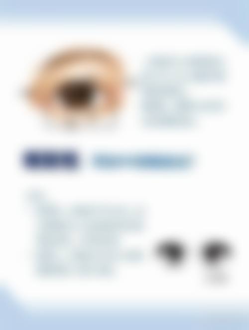 中南大学湘雅医院眼科擅长项目。