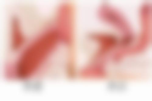 韓國術後幾天可以洗頭 價錢範圍(HKD/MOP)2026全新對比