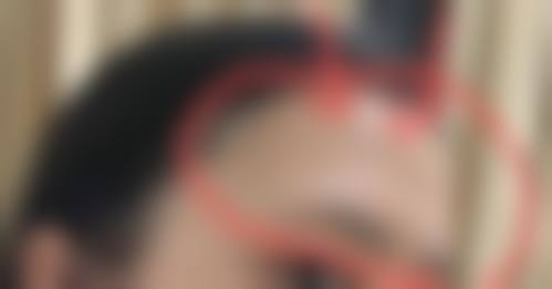 西宁万龄整形医院地理位置便于到院。