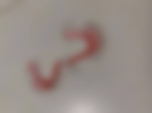 服务流程与保护:全程贴心,术后无忧
