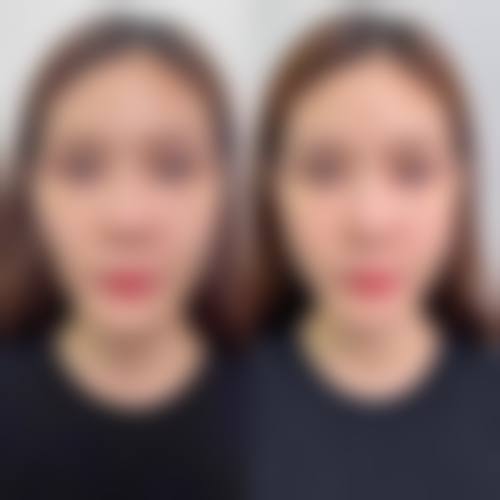 日照美丽华医疗美容擅长项目