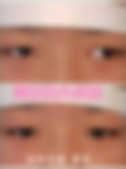贵州毕节威宁视康眼科医院擅长项目。