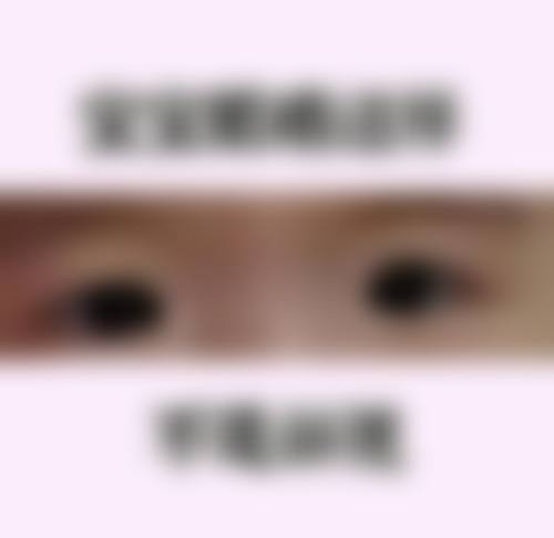 结语:选择武警重庆总队医院眼科,守护清晰视界