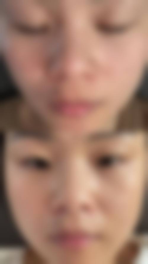 齐齐哈尔市非常好医院美容激光治疗中 心价格表/收费标准一览