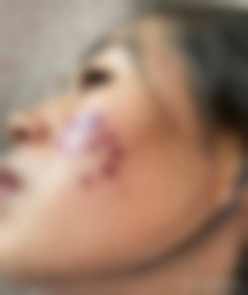 设备与环境:无菌手术室保护手术安心