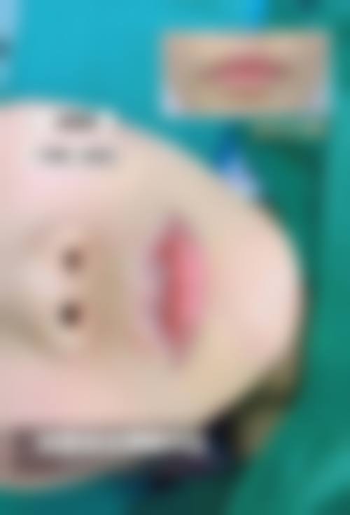 西宁万龄整形医院预约挂号方式。