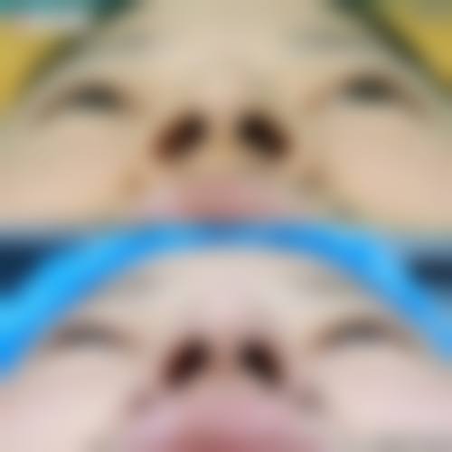 三.全维塑美方案——洛阳菜勒美元素焕新经典疗法矩阵