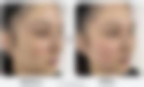 洛阳莱勒美元美丽提醒 — —春季塑美黄金期已开启!预约即赠皮肤屏障修护套装!