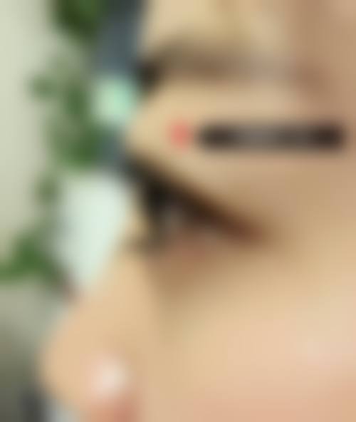 常州沁美人医疗美容门诊部治疗反馈与口碑评价。