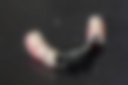 70 岁老人种牙危险吗？