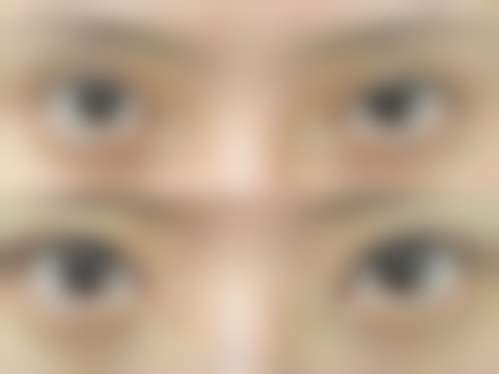 韩国BA整形外科医院特色诊疗项目