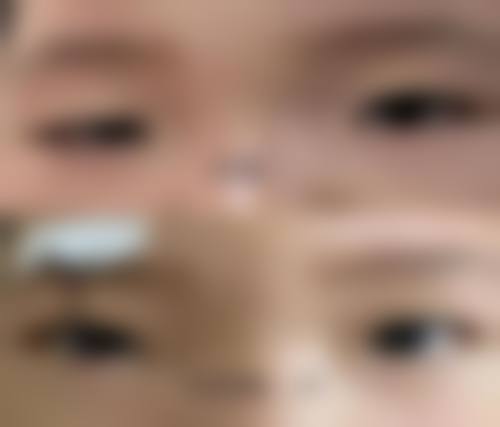 呼和浩特市亚太医疗美容医院擅长项目。