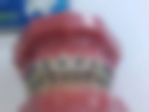 临床实例分享