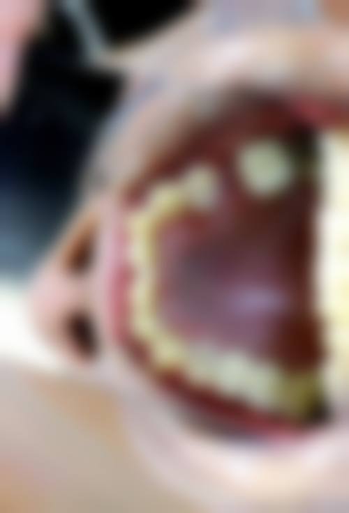栾益医生的技术实力