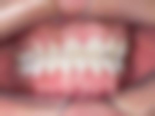 优惠活动详情与价格