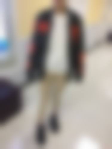 二、抽脂部位不同,消肿时间有何差异?