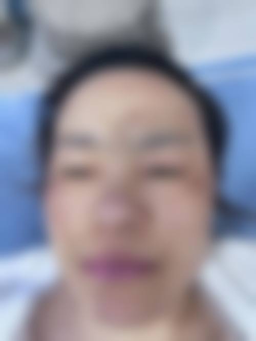 九、纾昕助理医生患者常见就诊关注点说明
