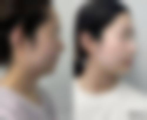 八、武汉甄美医疗美容医院口碑好不好?患者诊室评价: