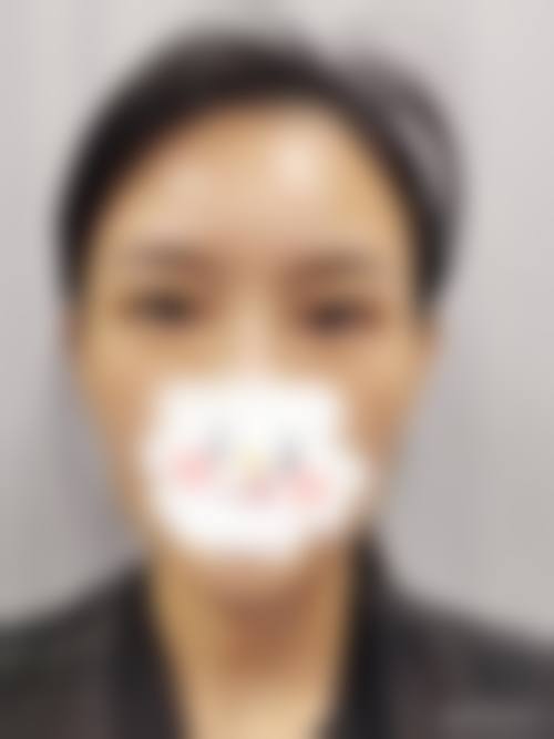 云县人民医院眼科门诊营业时间。