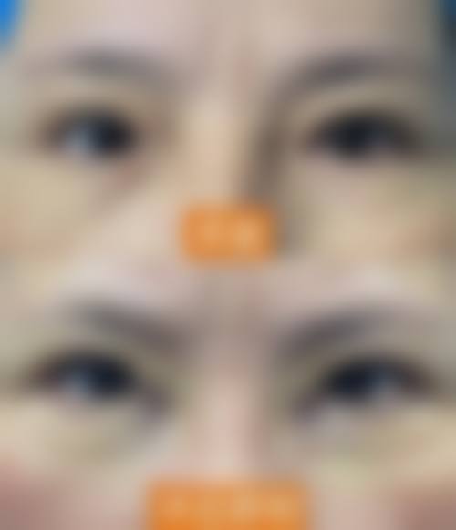 云县人民医院眼科擅长项目。
